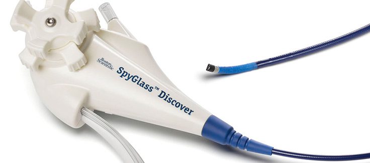 SpyGlass™ Discover 3-1000
